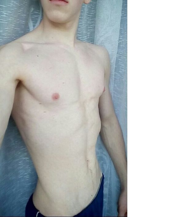 ........