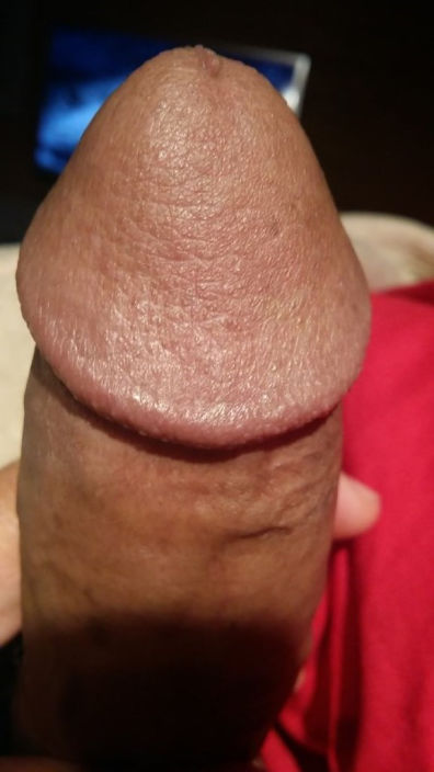 my penis