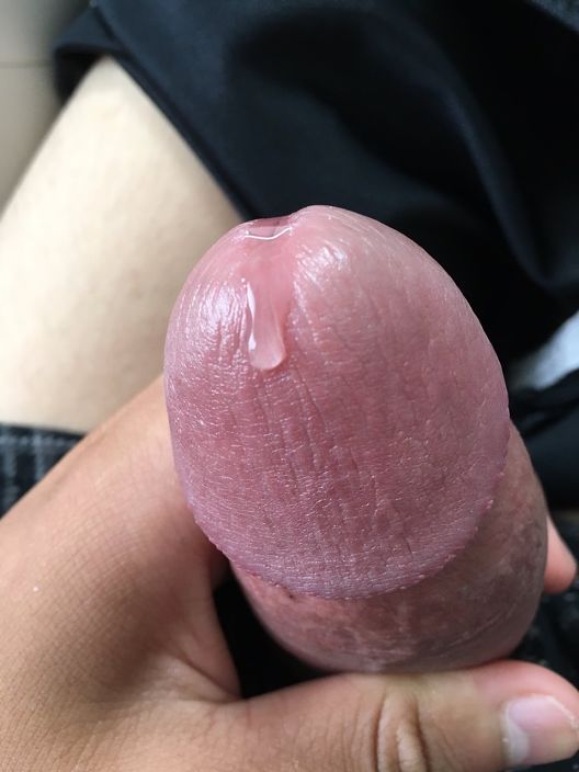 111