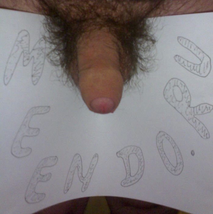 First photo