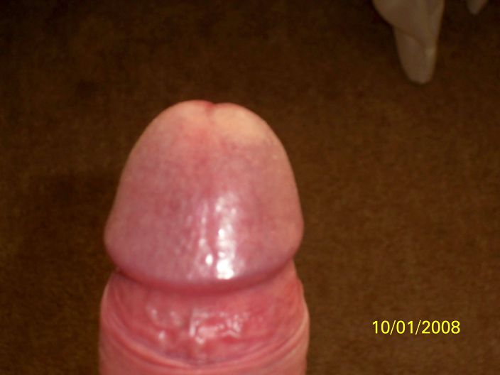 First photo