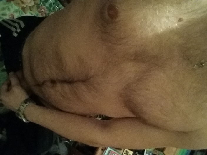 :)p