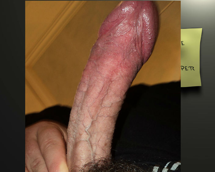 ----------