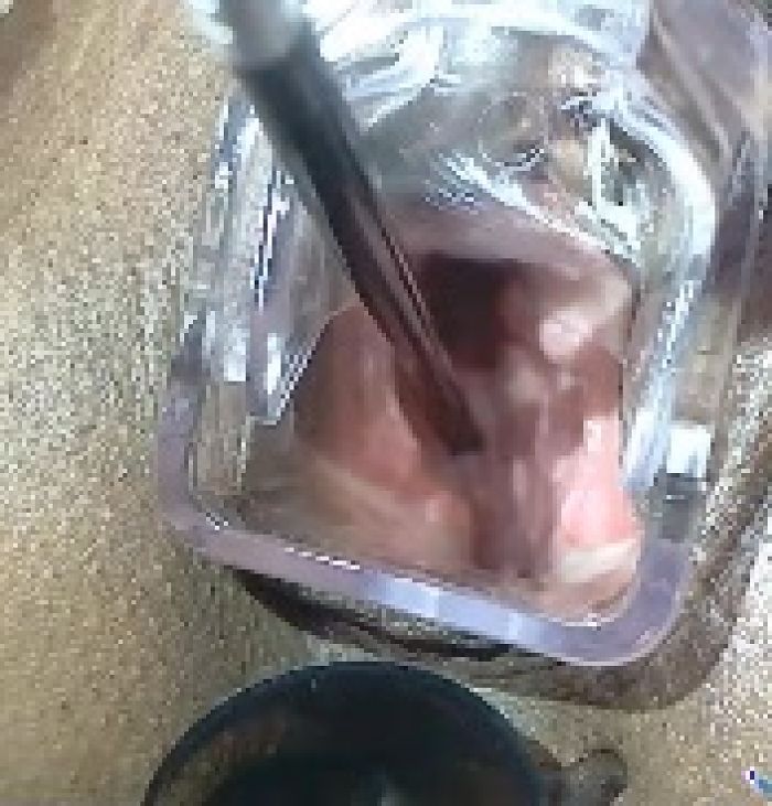 ШЕЙКА МАТКИ