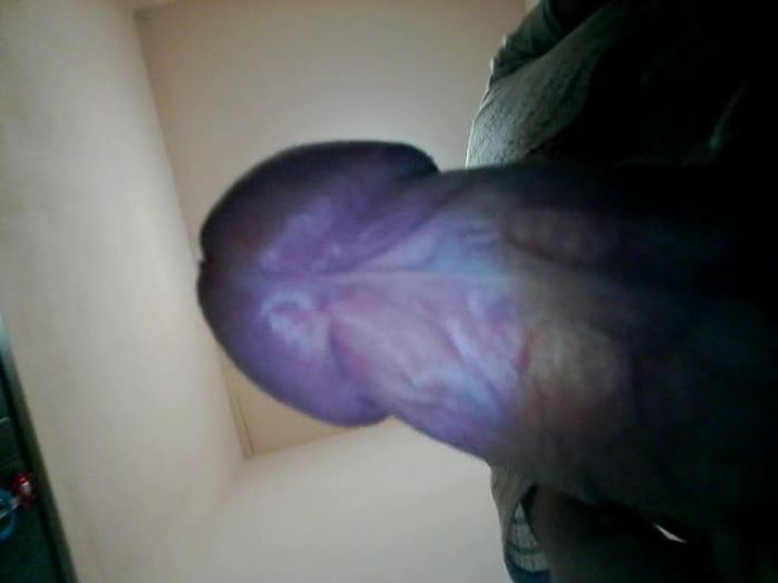 Брызнул на камеру.