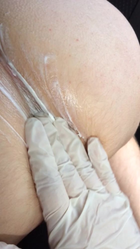 Экспресс фистинг